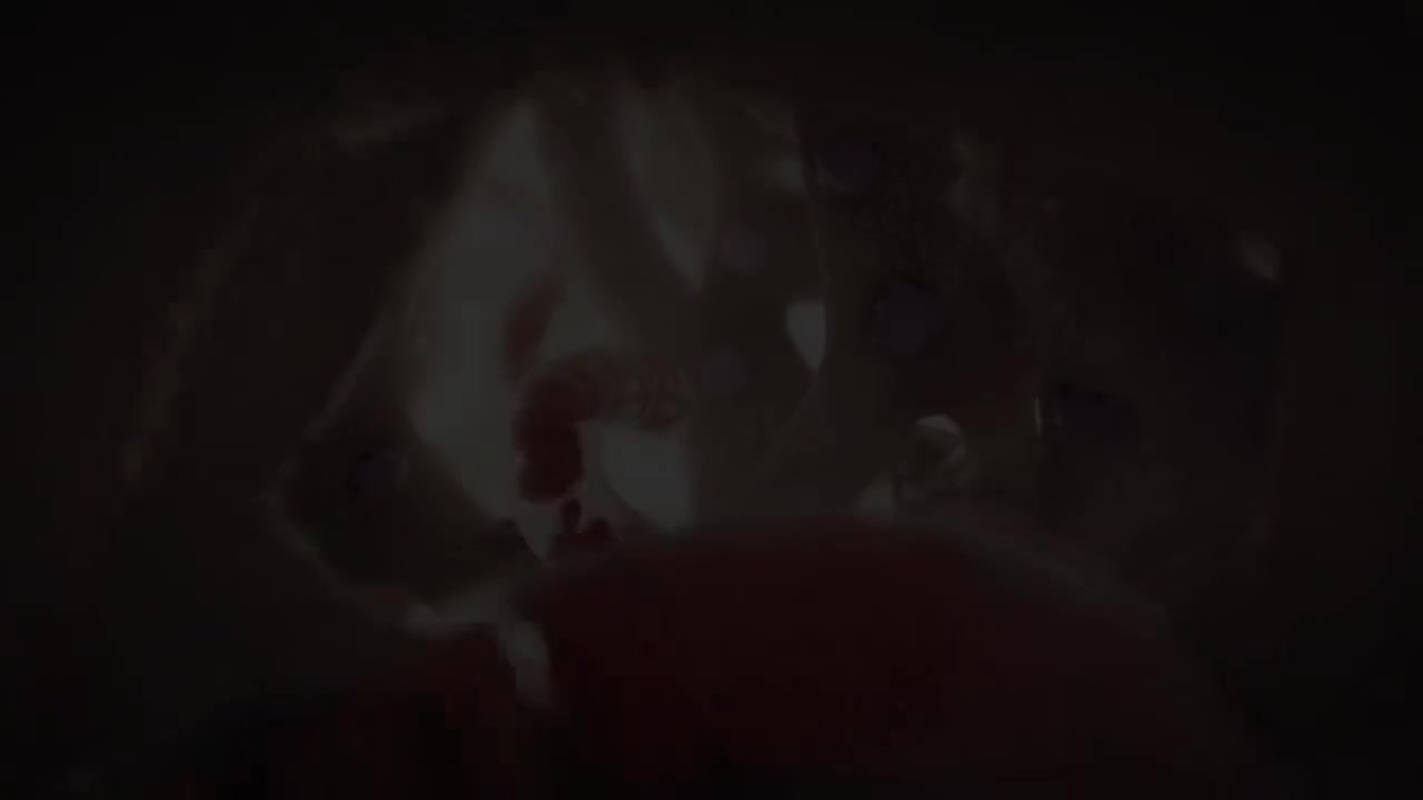 类风湿性关节炎动画 80-Rheumatoid Arthritis Animation