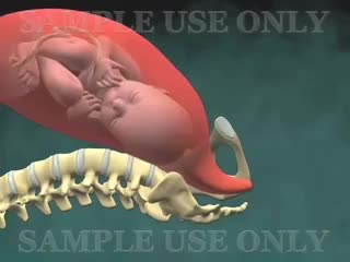 正常阴道分娩 99-Naissance Vaginale Normale