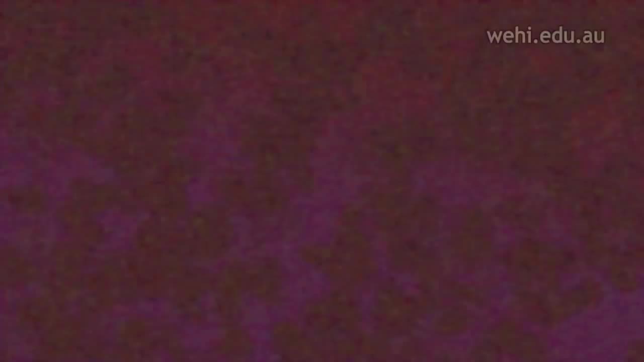 血红蛋白和镰状细胞性贫血 43-Haemoglobin and Sickle Cell Anaemia