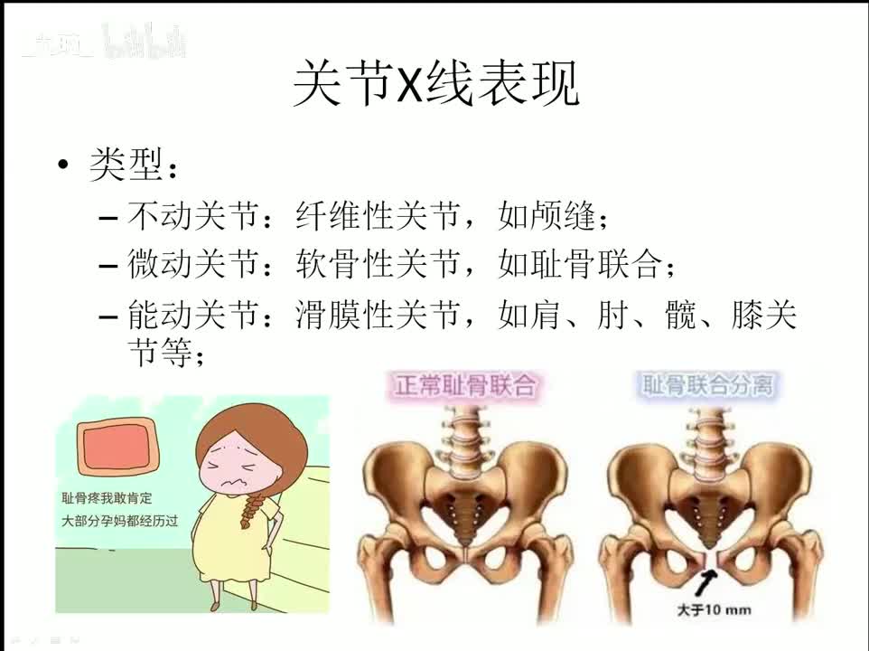 35 骨骼肌系统-3-基本病变1
