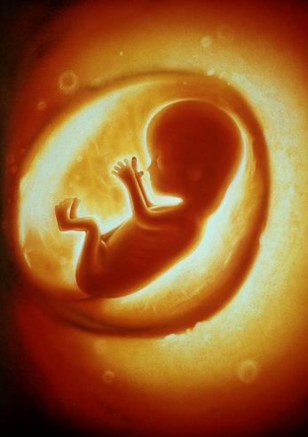 怀孕13周的胎儿图片图片