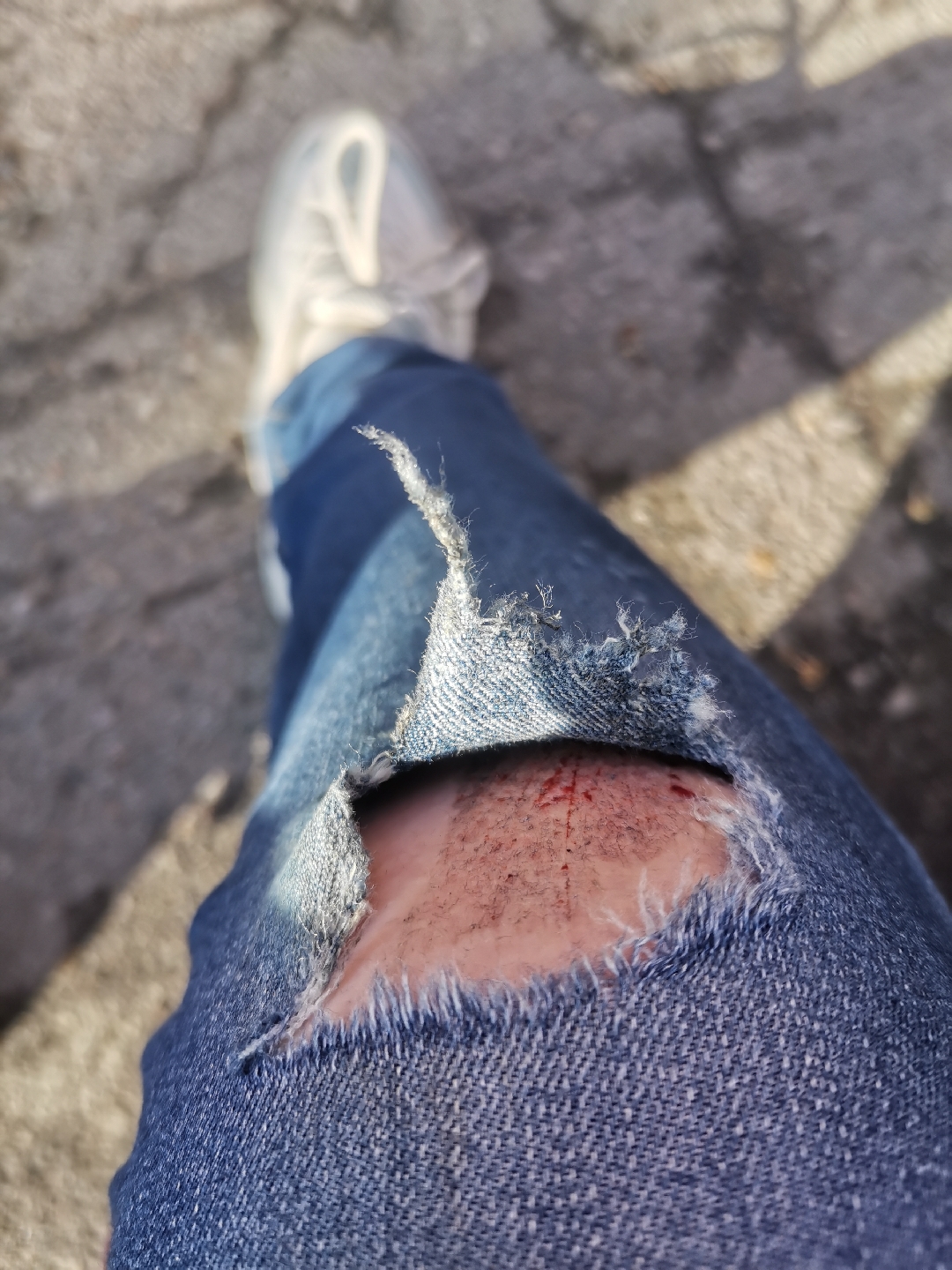 骑车裤子摔坏的照片图片