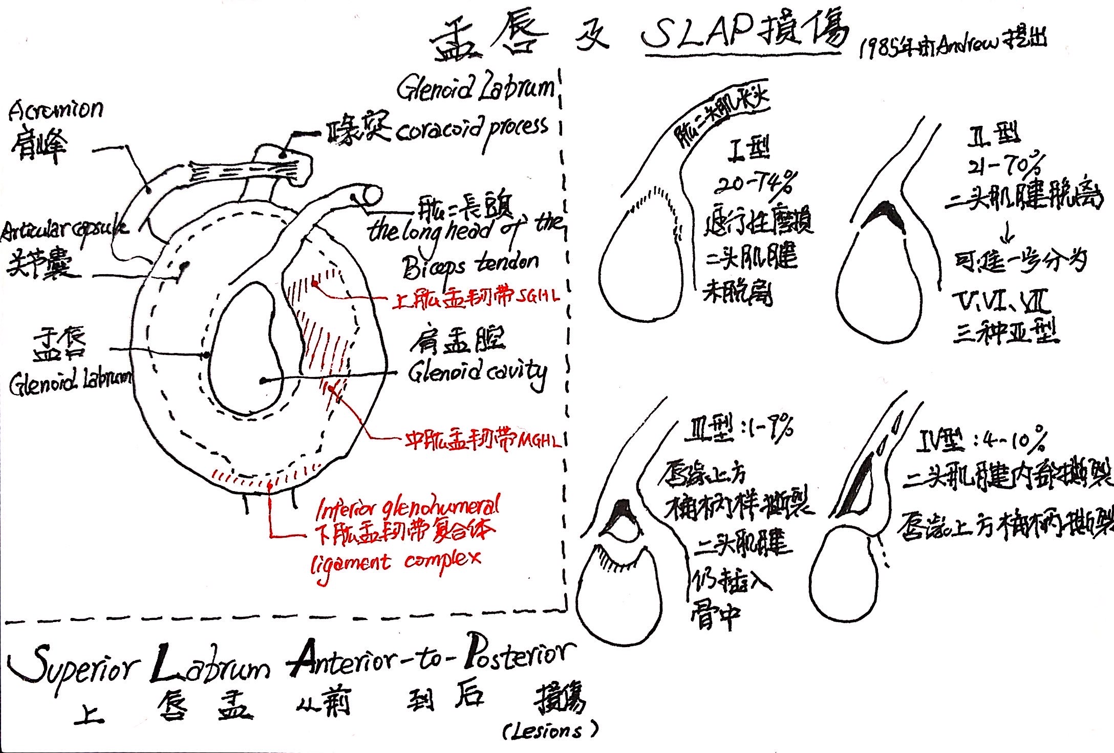 slap损伤图片