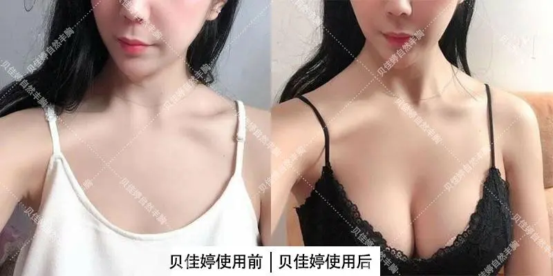 乳房不对称一高一低怎么办用这三招就对了 哔哩哔哩