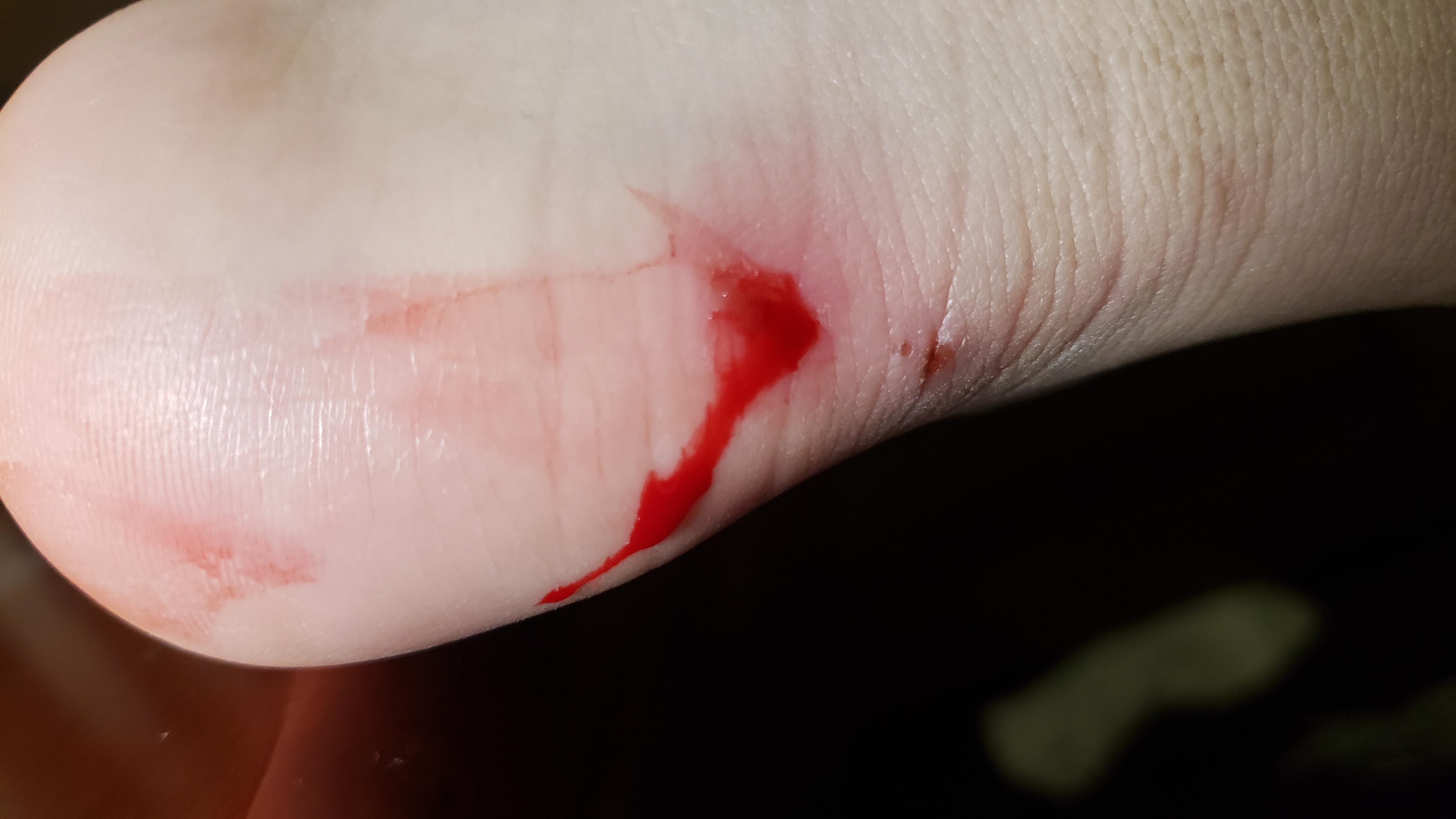 ojbk 我真没想到脚上这个伤这么深 刚才抻了一下留了一堆血 擦掉之后