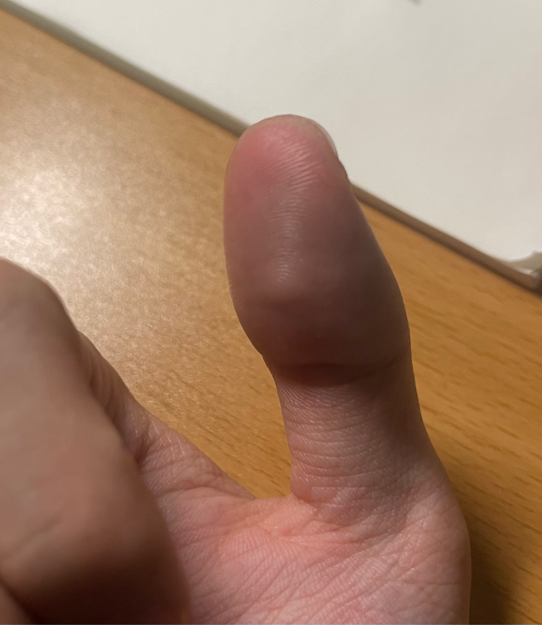 玩金鸣的下场,大拇指指尖一大层厚茧[囧]