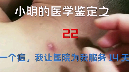 【医学鉴定】网络热门医学视频鉴定22哔哩哔哩bilibili