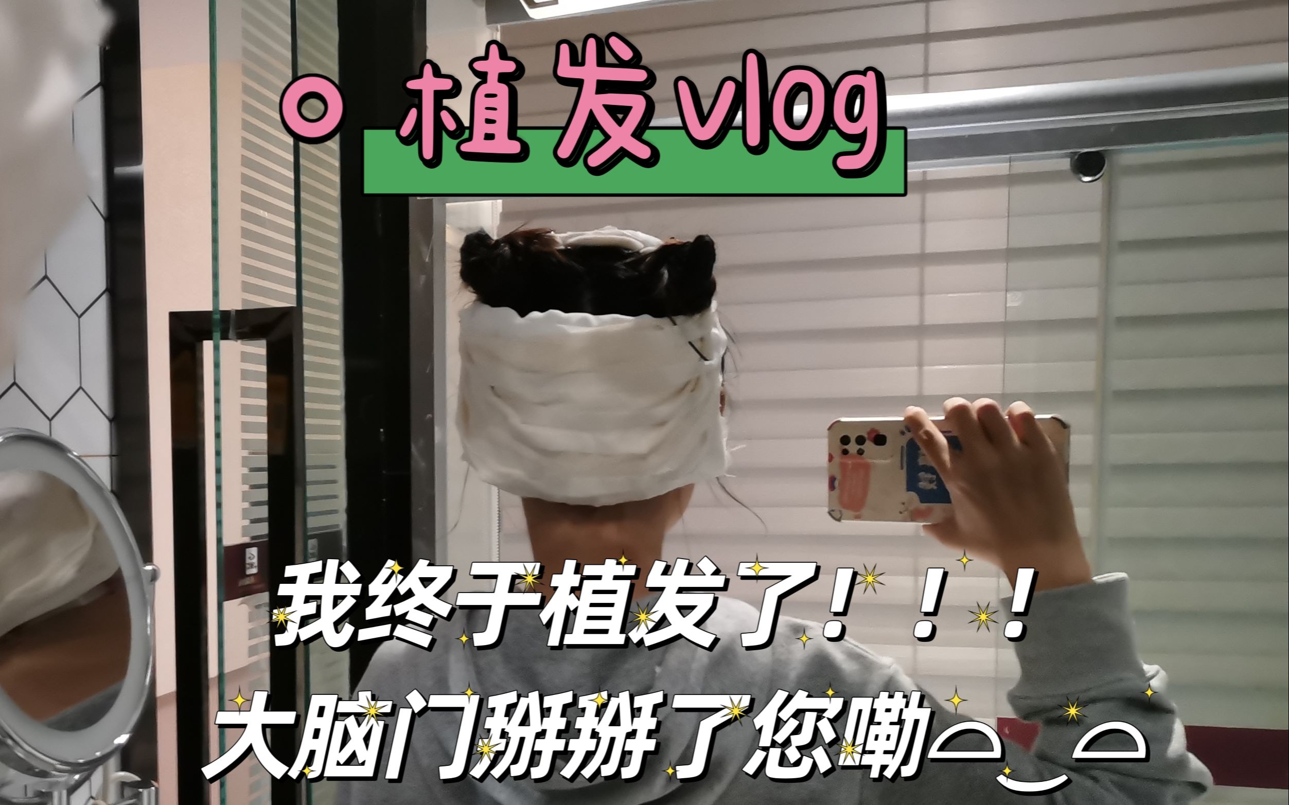 植发vlog/ 植发一时爽,恢复很漫长 头发啊请你茁壮成长哔哩哔哩bilibili