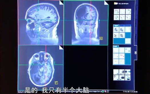 [图]【纪录片】神奇的大脑（中英文全2集）