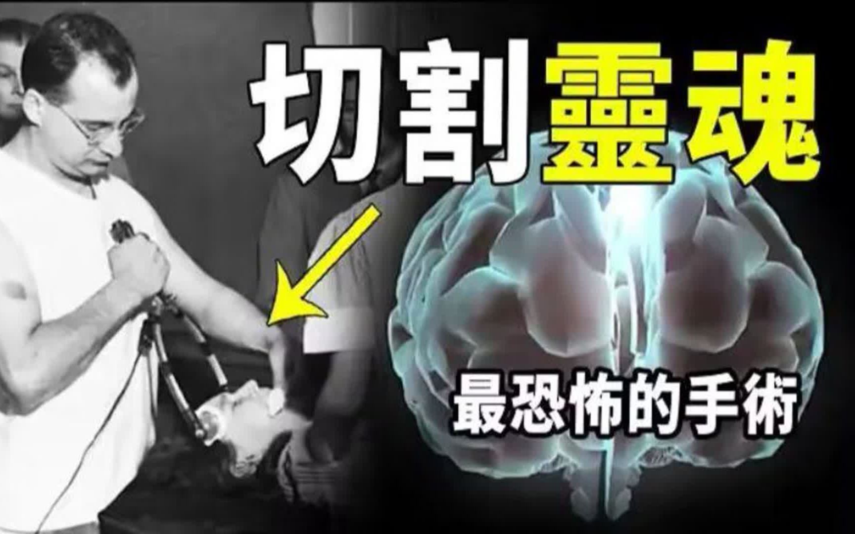 [图]切割灵魂的医学实验！把左右脑分离后，出现诡异现象！