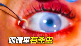 女人眼睛看不见东西，从她眼里拽出了几条虫子