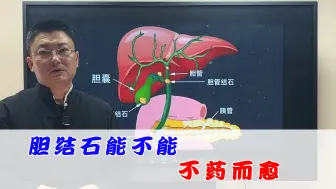 Download Video: 胆结石不吃药不手术，能不能不药而愈？