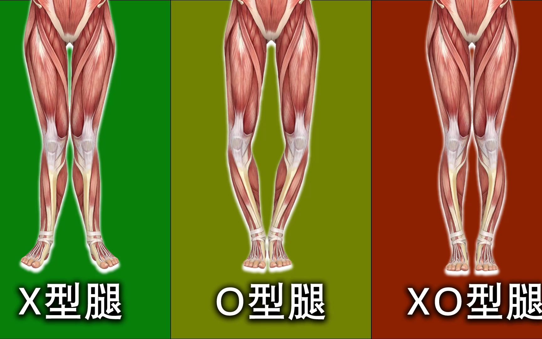 XO型腿+小腿缝隙大？高效直腿的矫正动作来啦！ - 哔哩哔哩