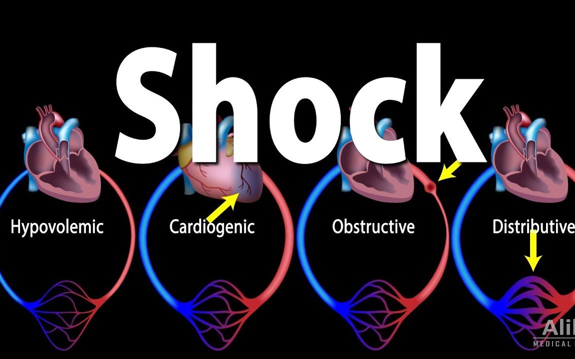 [图]动画 | 休克的类型、病因、症状与诊断