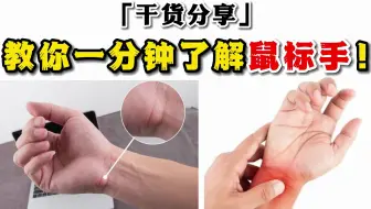 教你一分钟了解鼠标手！