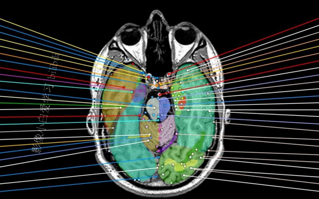1.颅脑MRI解剖图谱颅脑MRI轴位解剖哔哩哔哩bilibili