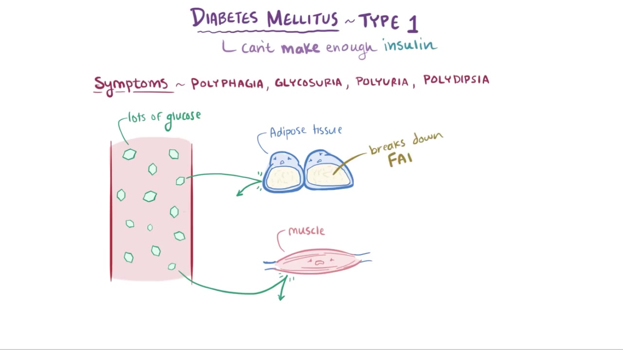 (搬运油管Osmosis)Diabetes mellitus (type 1, type 2) & diabetic ketoacidosis (DKA)哔哩哔哩bilibili