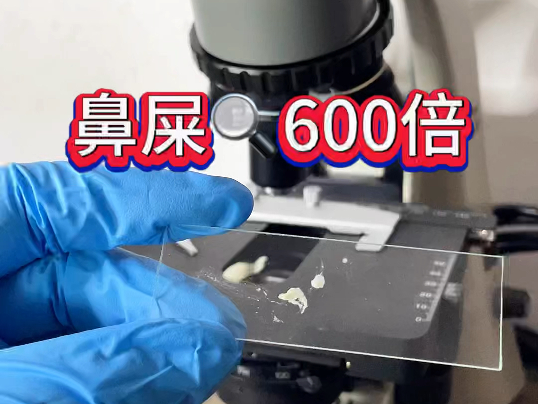 有谁小时候吃过鼻屎的,出来来报个到 #微观世界 #显微镜 #科普