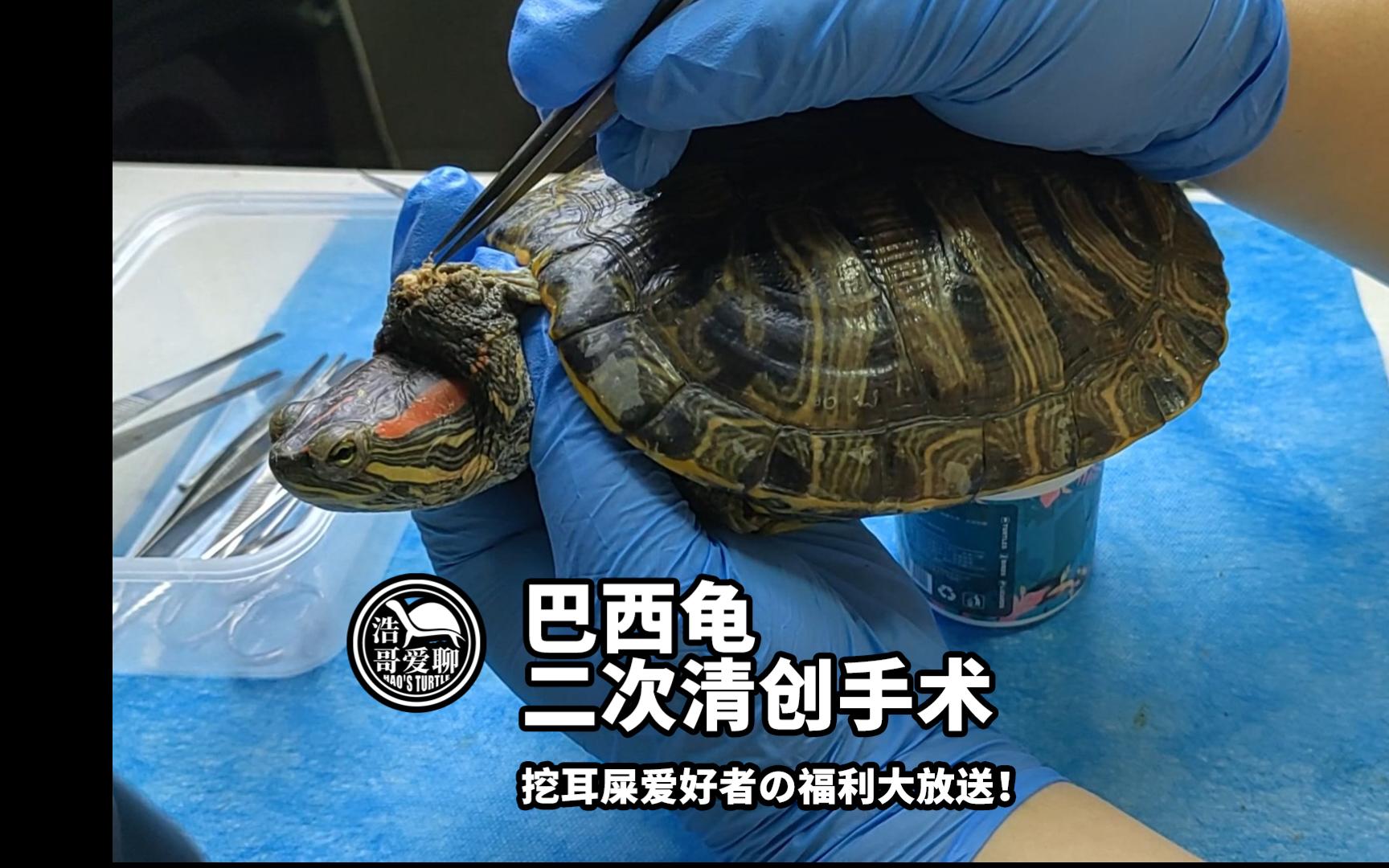 巴西龟脂肪瘤二次清创手术