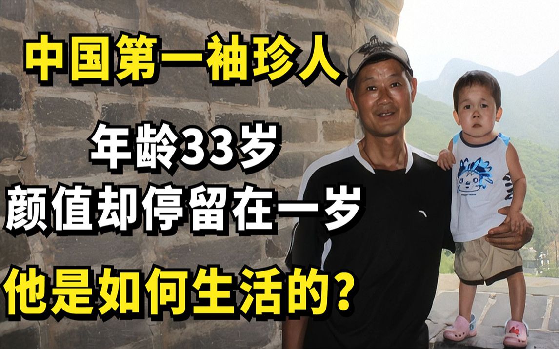 中国第一袖珍人,年龄33岁,颜值却停留在一岁,他是如何生活的?哔哩哔哩bilibili