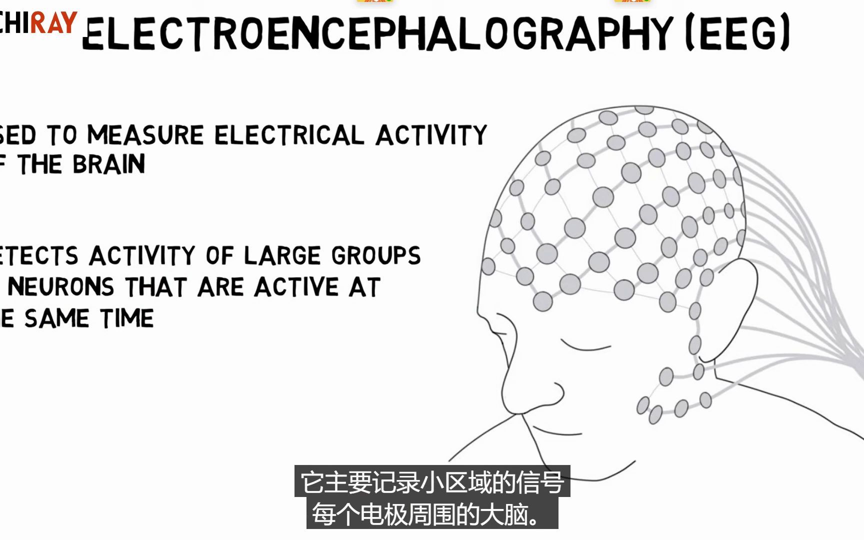 【思知瑞科技】大脑实验室 2 分钟l了解 神经科学:脑电图 (EEG) 脑电波 脑波哔哩哔哩bilibili