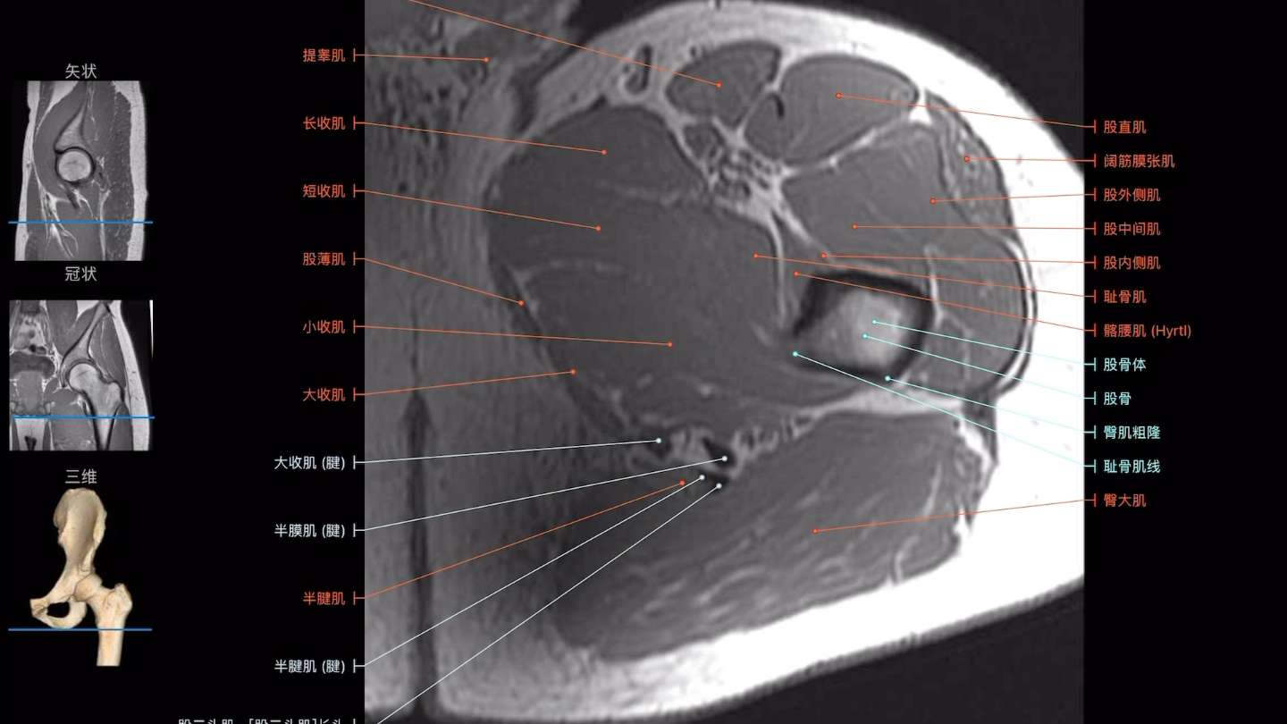 [图]不好用麻烦来打我，强烈推荐一个断层影像解剖图谱软件 e-anatomy！