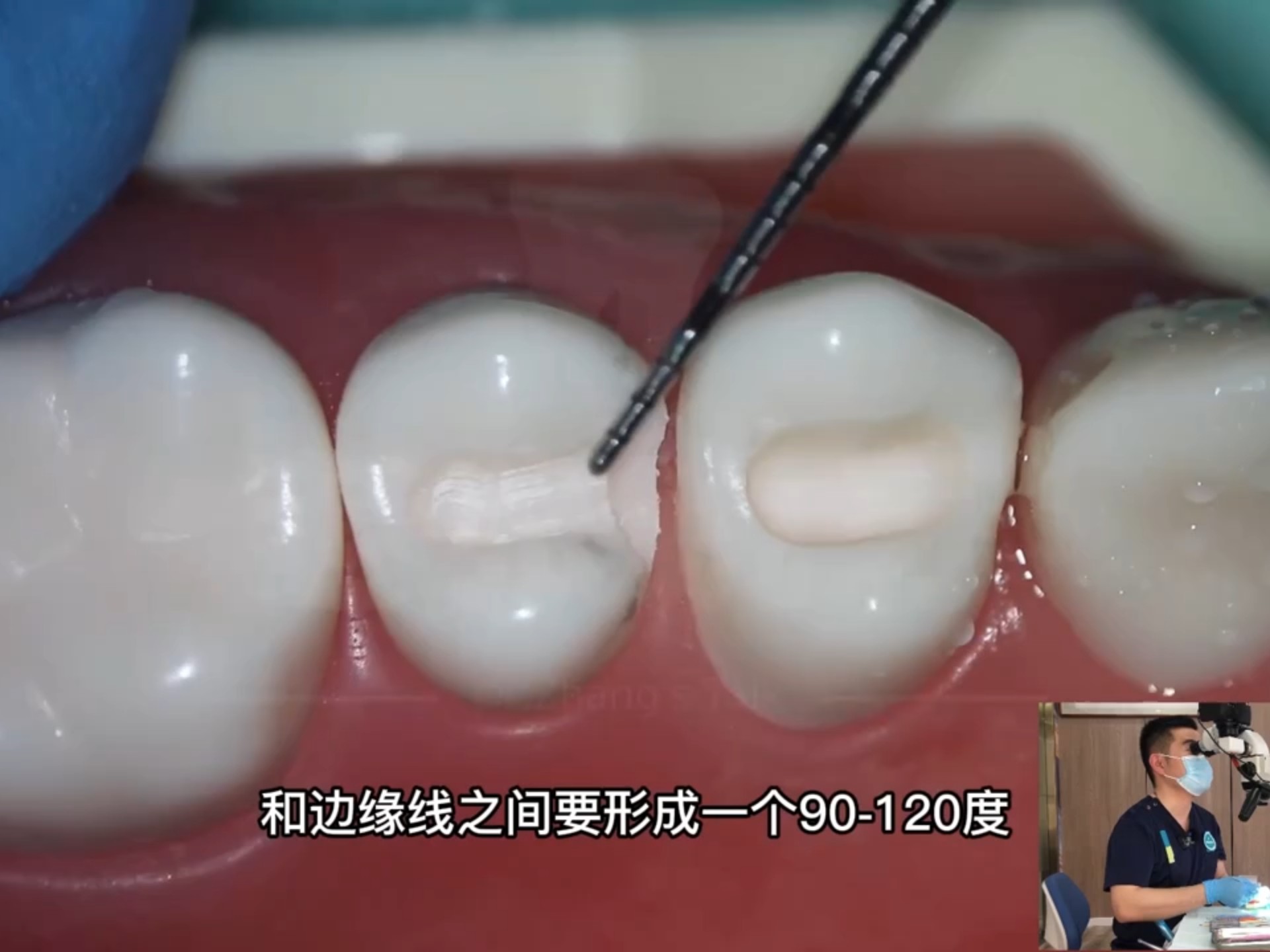 张林各种嵌体预备实操示教2