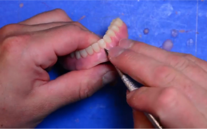 胶托下颌排牙制作by gp dental lab#胶托#排牙#牙匠之家