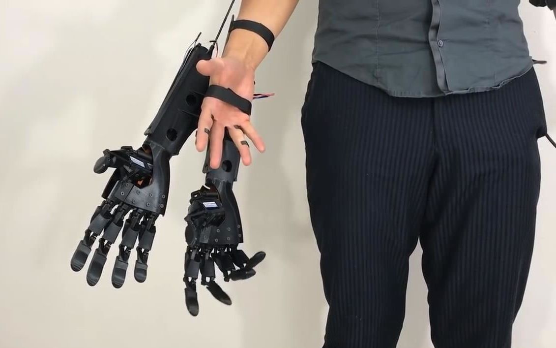老外发明这机械手,让你单手变双手,能控制抓握,你会用来做什么