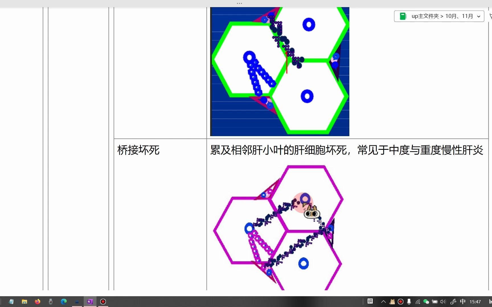 肝损伤的基本病理变化哔哩哔哩bilibili