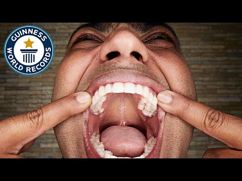 世界上牙齿最大的人图片
