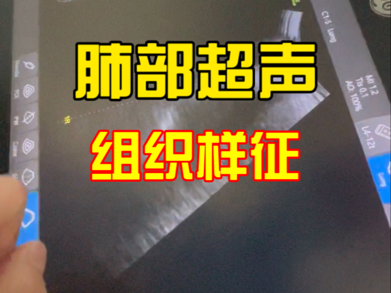 肺部超声：肺实变和肺不张的组织样征。
