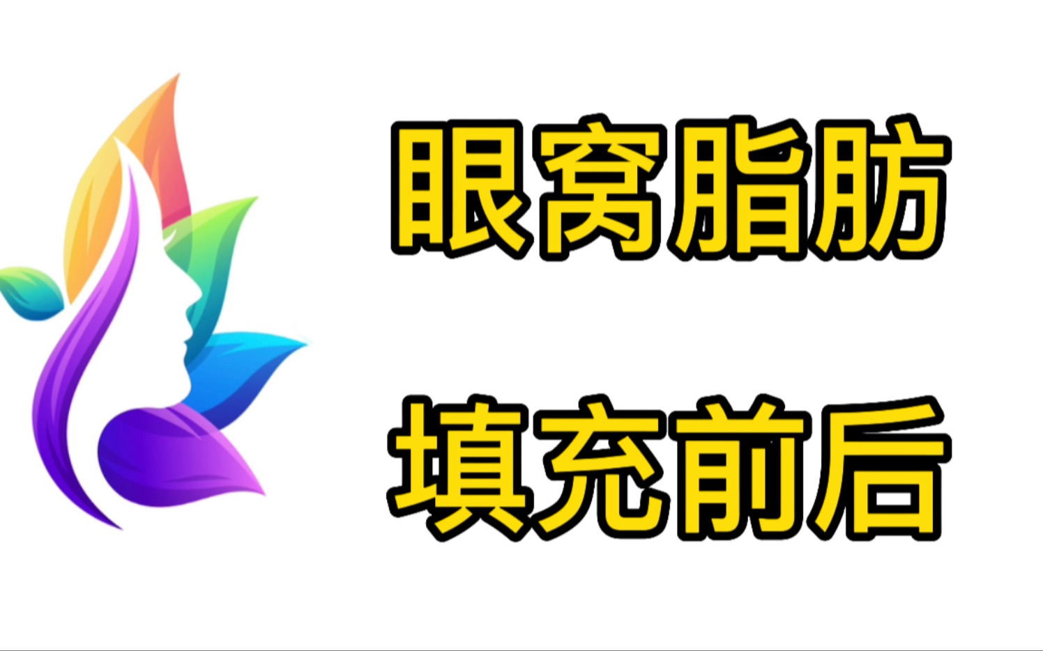 我的脂肪填充维持了5年~眼窝脂肪填充前后图片看过来~哔哩哔哩bilibili