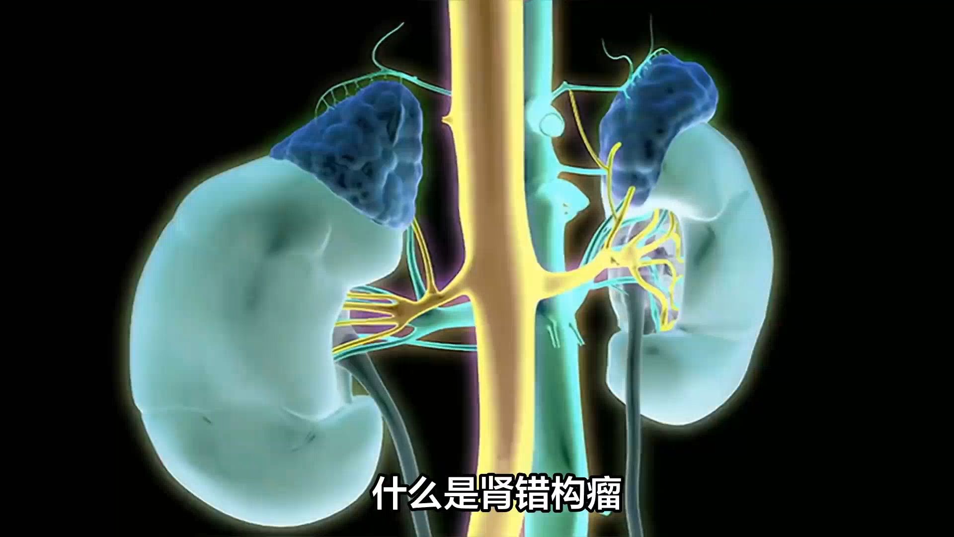 聊一聊"肾错构瘤"