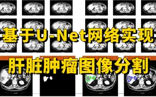 Download Video: 【附源码】医学人工智能项目实战：基于U-Net网络实现肝脏肿瘤图像分割，从环境部署到项目实战，究极通俗易懂！