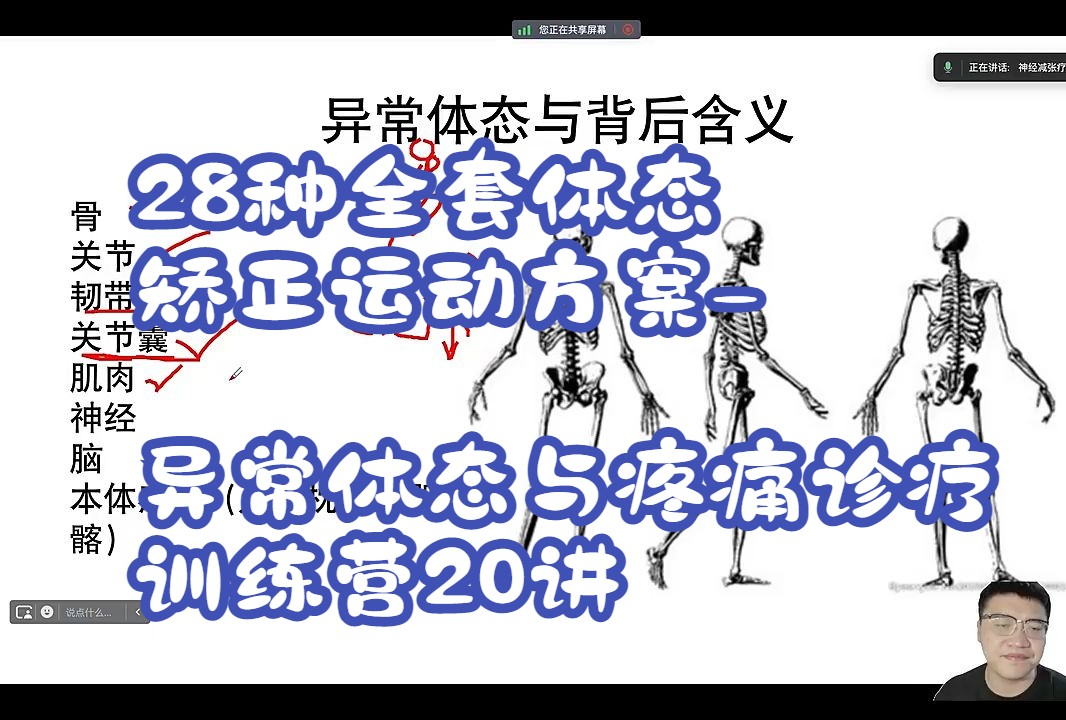 28种全套体态矫正运动方案\异常体态与疼痛诊疗训练营20讲哔哩哔哩bilibili