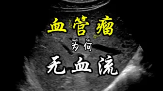 Download Video: 血管瘤为何无血流