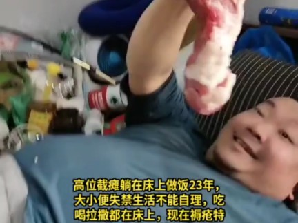 19岁时一场车祸导致高位截瘫,脊髓损伤从嘎吱窝一下没有知觉,大小便