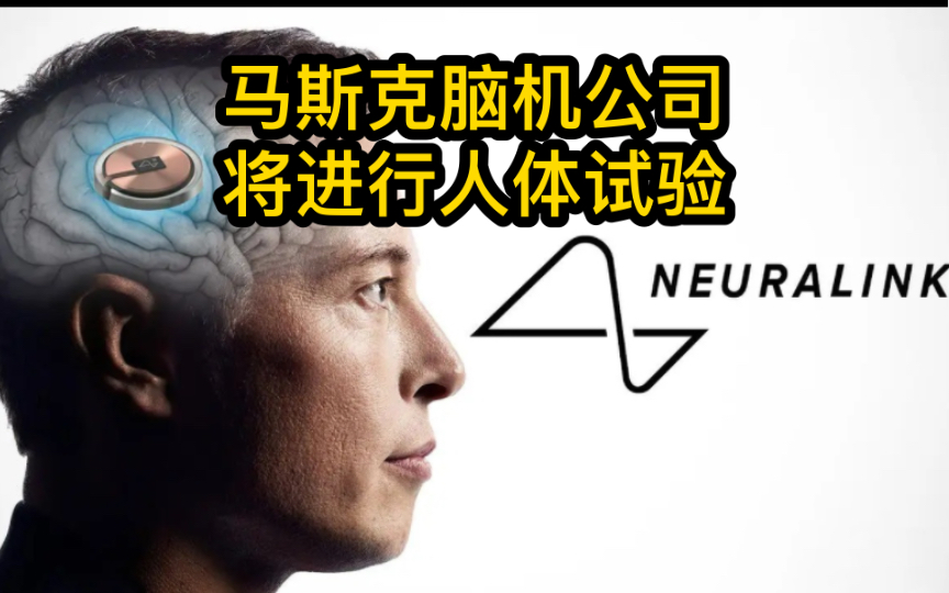 马斯克的脑机接口公司,将对世界的未来发生怎样的影响?哔哩哔哩bilibili