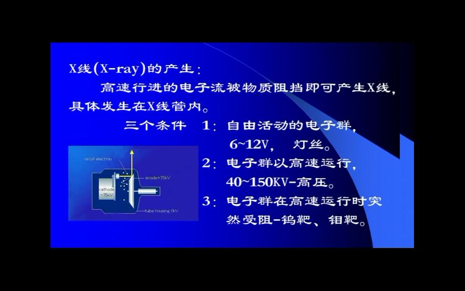 [图]01X线诊断基础----中山大学《放射诊断学》