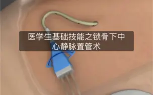 下载视频: 适合医学生反复观看并熟记的技能之锁骨下中心静脉置管术