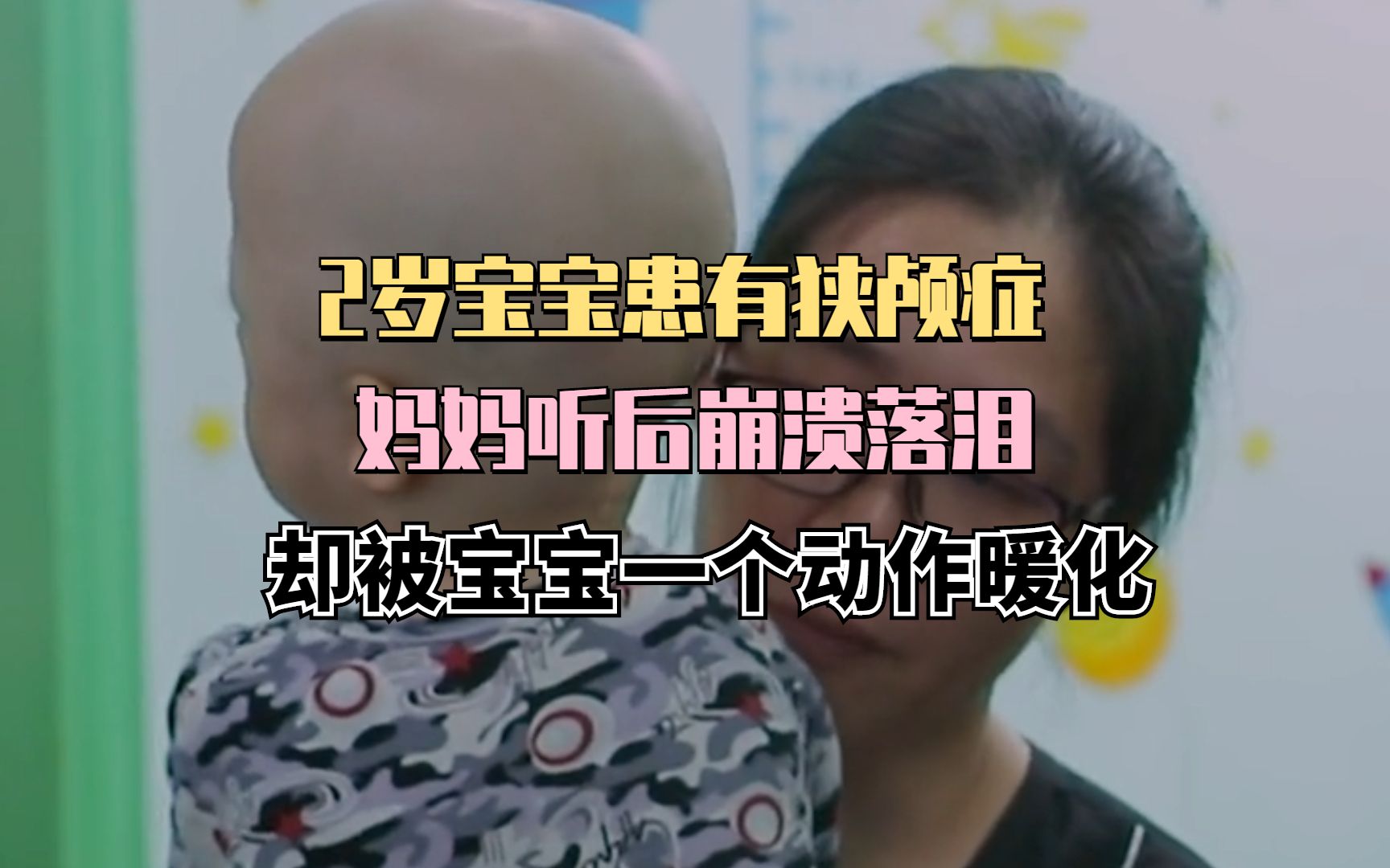 2岁宝宝患有狭颅症妈妈听后崩溃落泪却被宝宝一个动作暖化