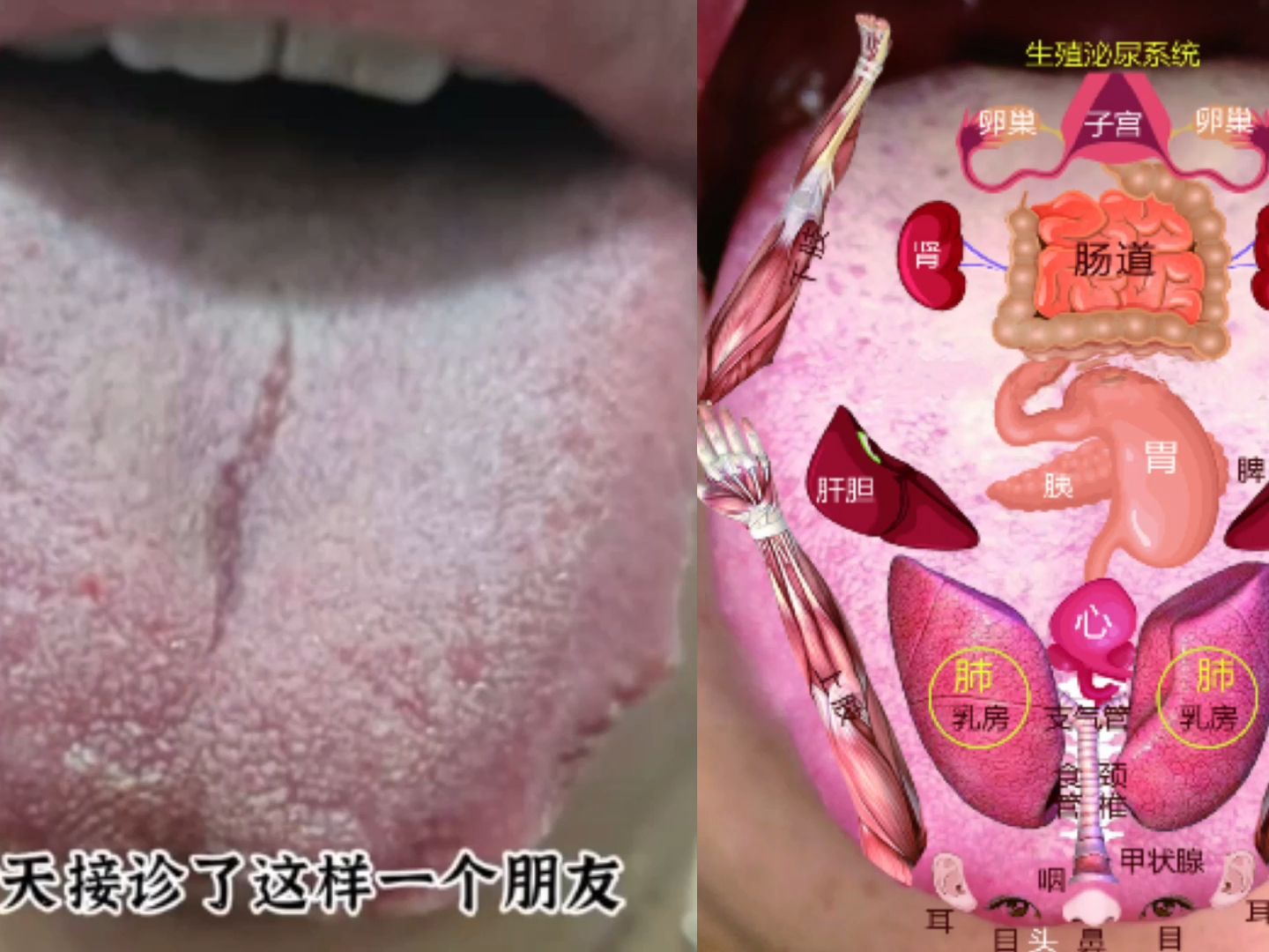 舌诊分析:一旦遇到这种舌头,再补也没用,罪魁祸首在肝!