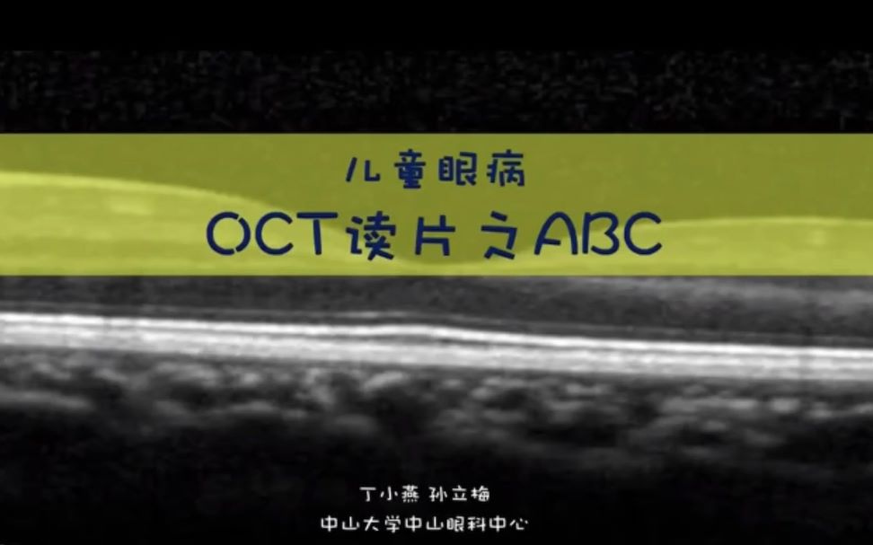 [图]儿童眼病OCT读片之ABC——丁小燕（中山大学中山眼科中心）