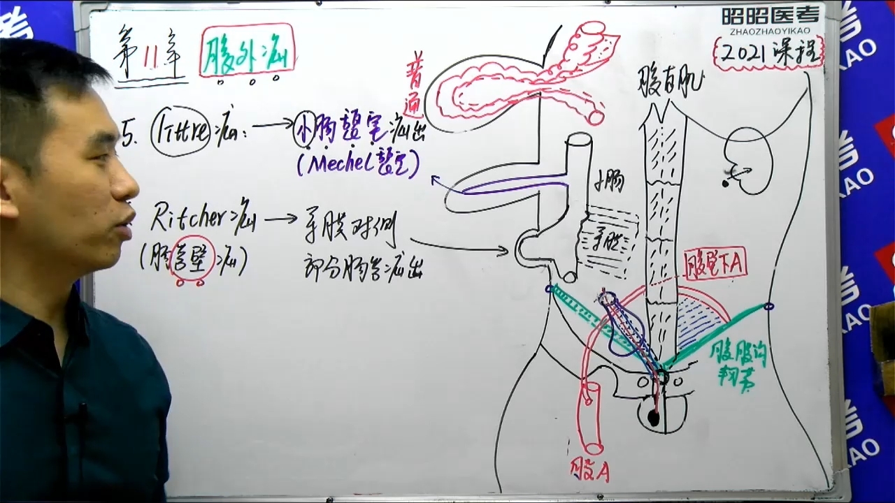 [图]消化系统-11腹外疝2