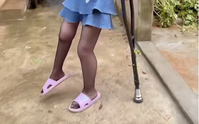 polio儿麻女生穿拖鞋走路会掉吗?