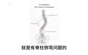 Download Video: Cobb角度的测量：测量脊柱侧弯关键指标！