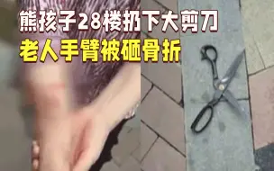 Descargar video: 5岁熊孩子28楼扔下大剪刀 六旬老人手臂被砸骨折