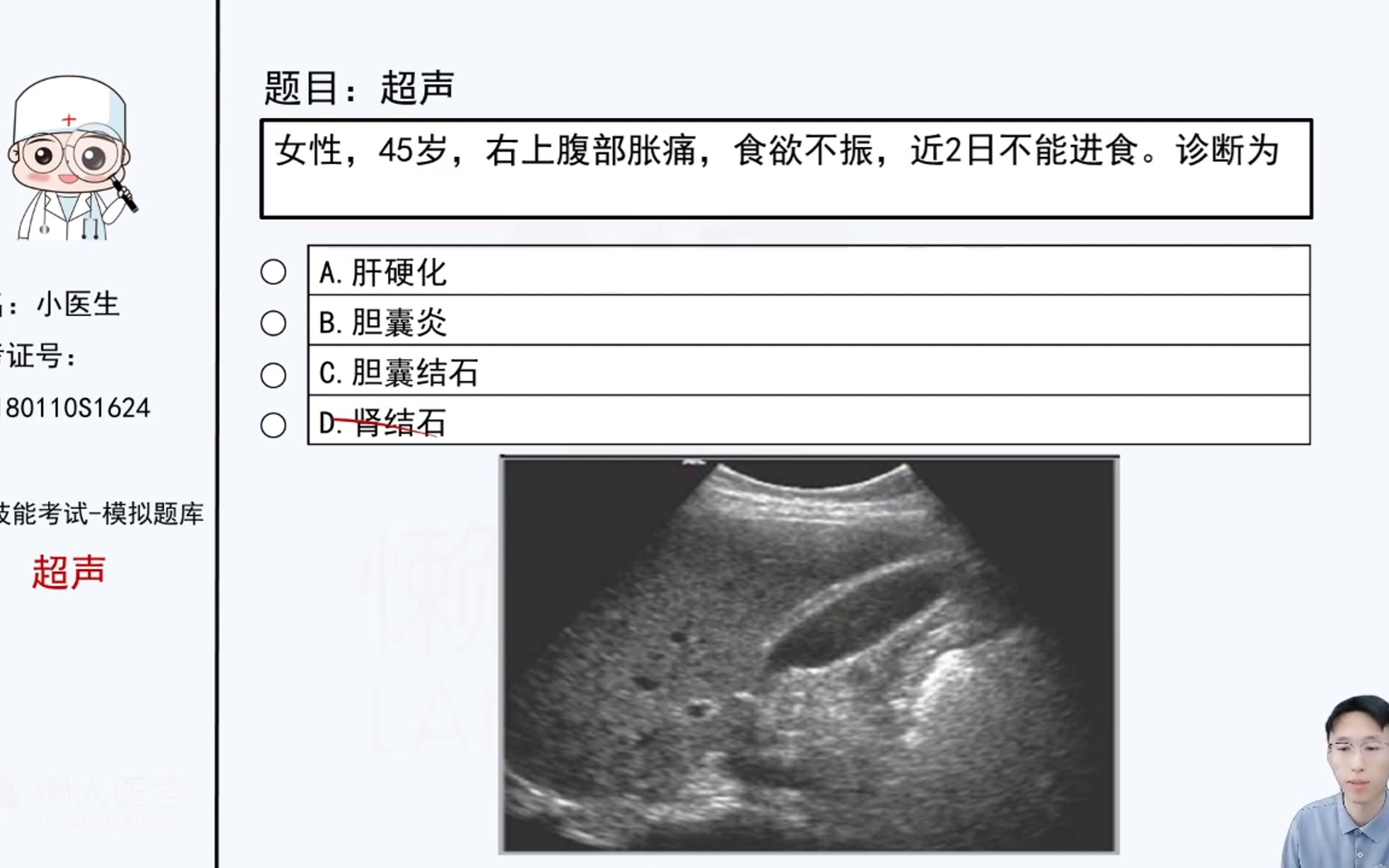 实践技能考试多媒体 超声诊断押题!哔哩哔哩bilibili