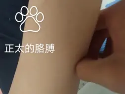 下载视频: 正太软软的胳膊